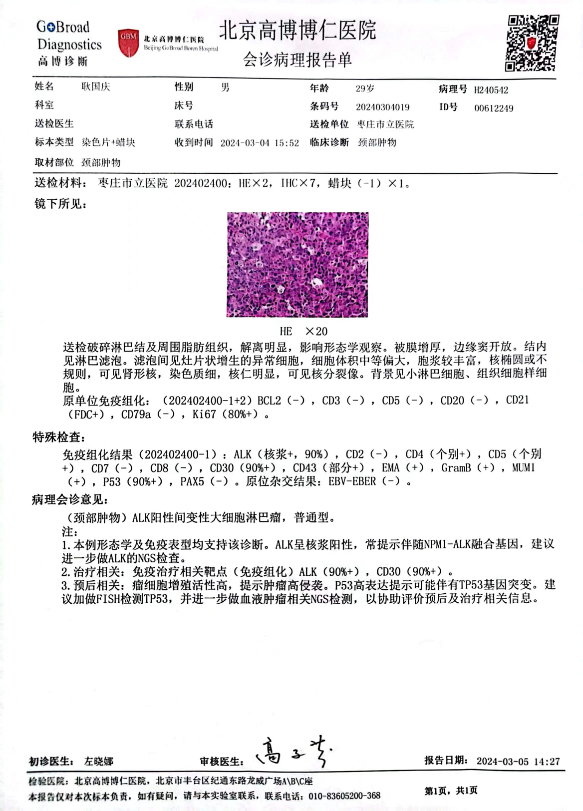 alk 间变性大细胞淋巴瘤确诊