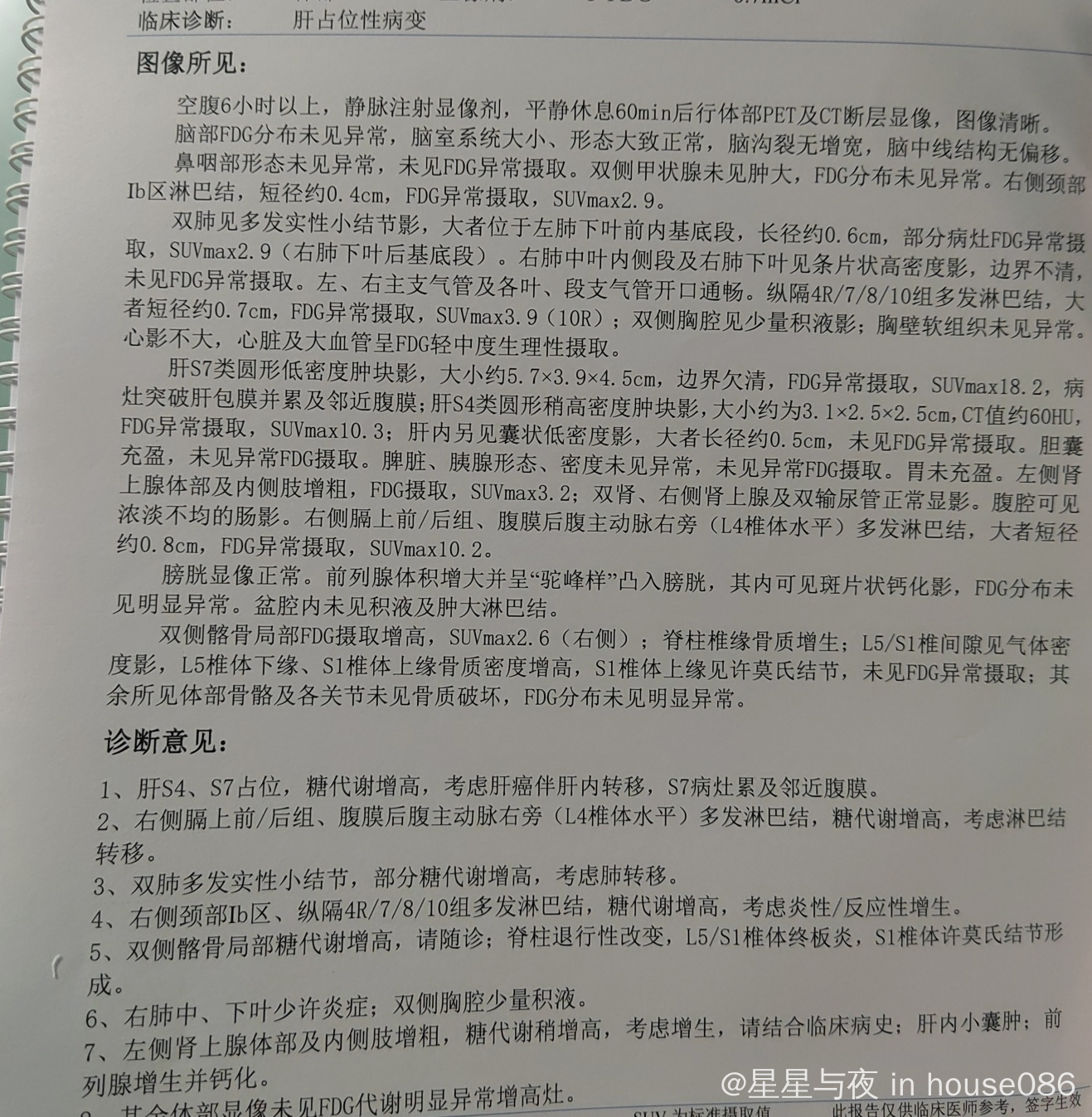 难治alk 阴性间变大细胞淋巴瘤