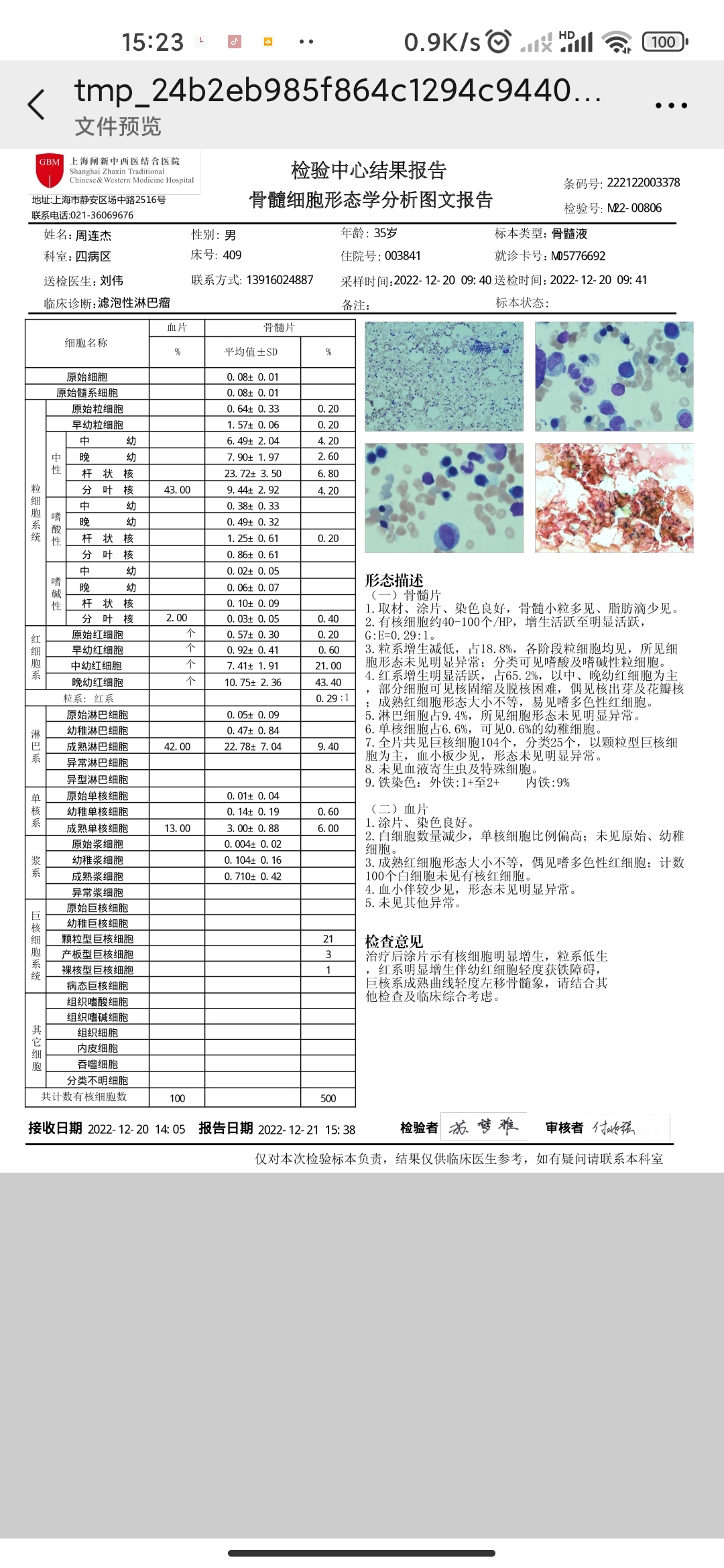 懂的来看看骨穿报告吧