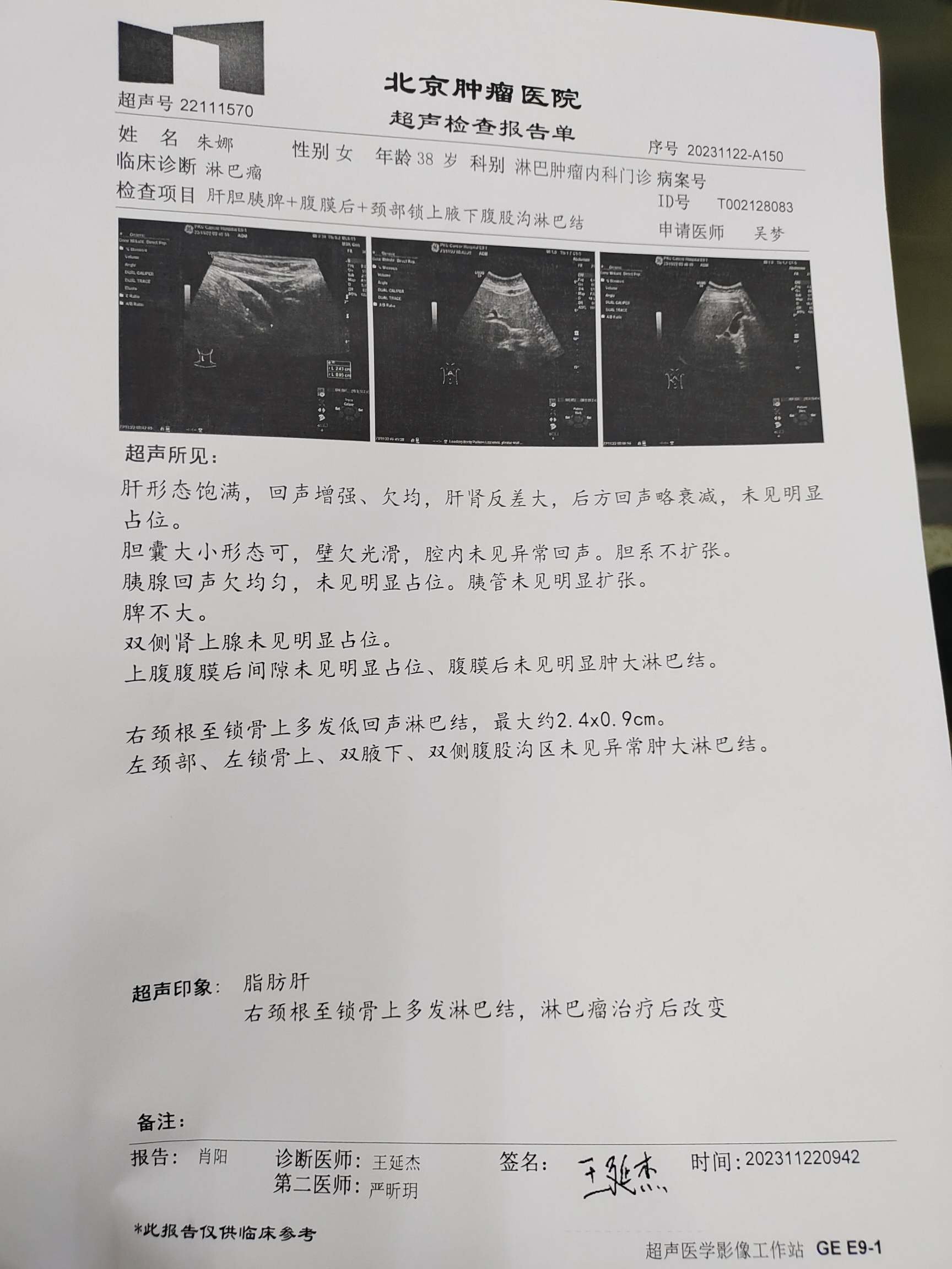 颈部多发小淋巴结影增强扫描可强化