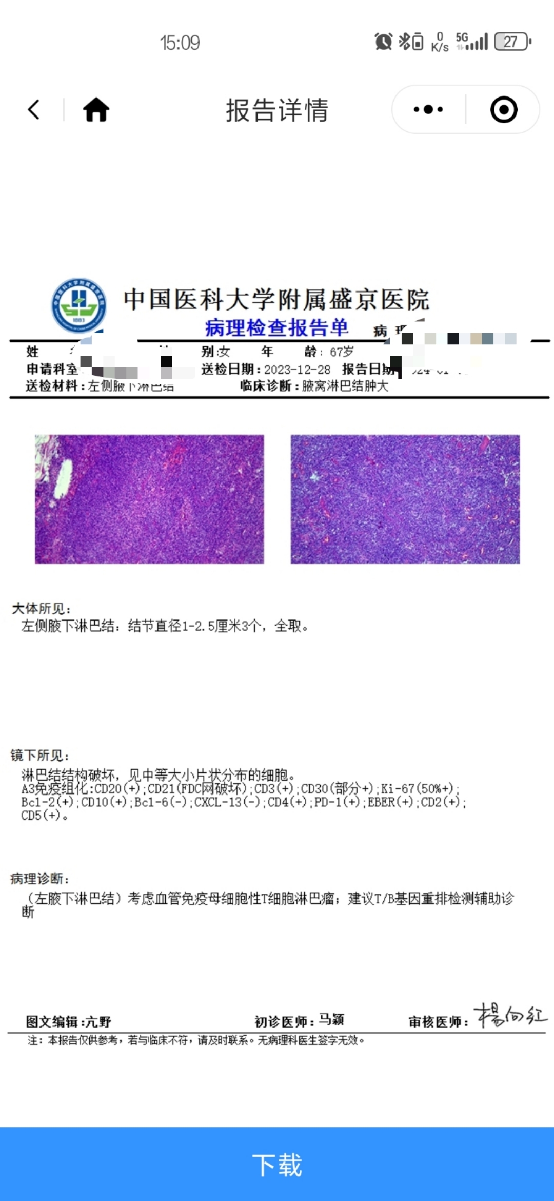 淋巴瘤之家