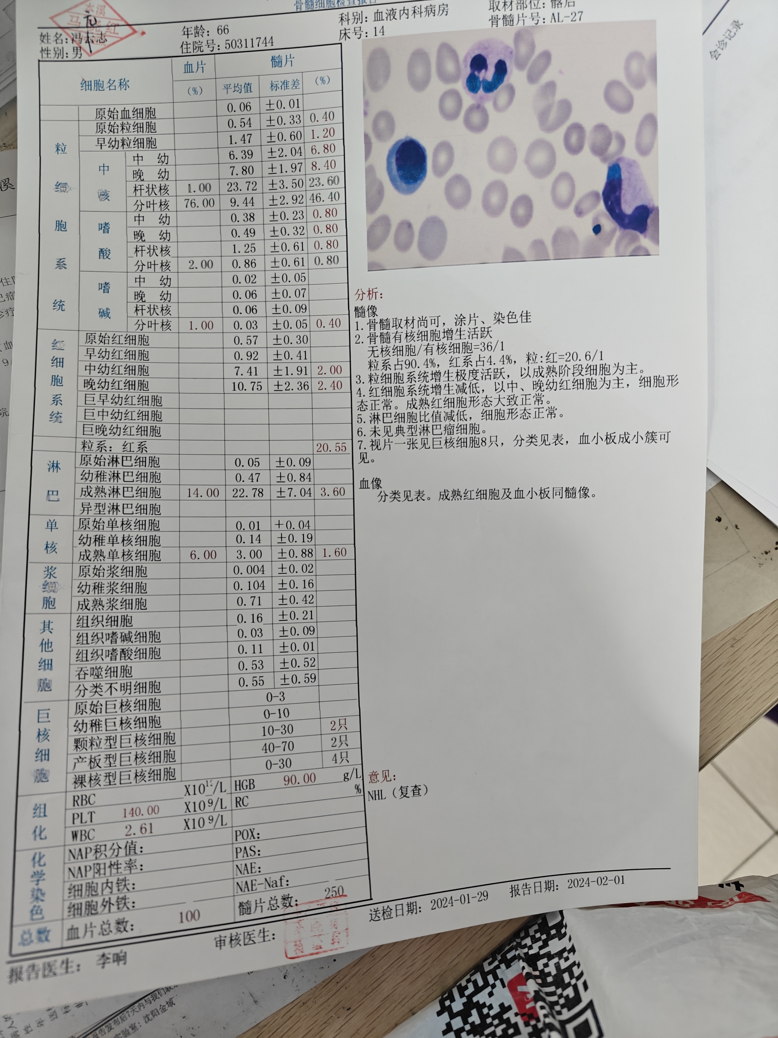 骨穿报告图片