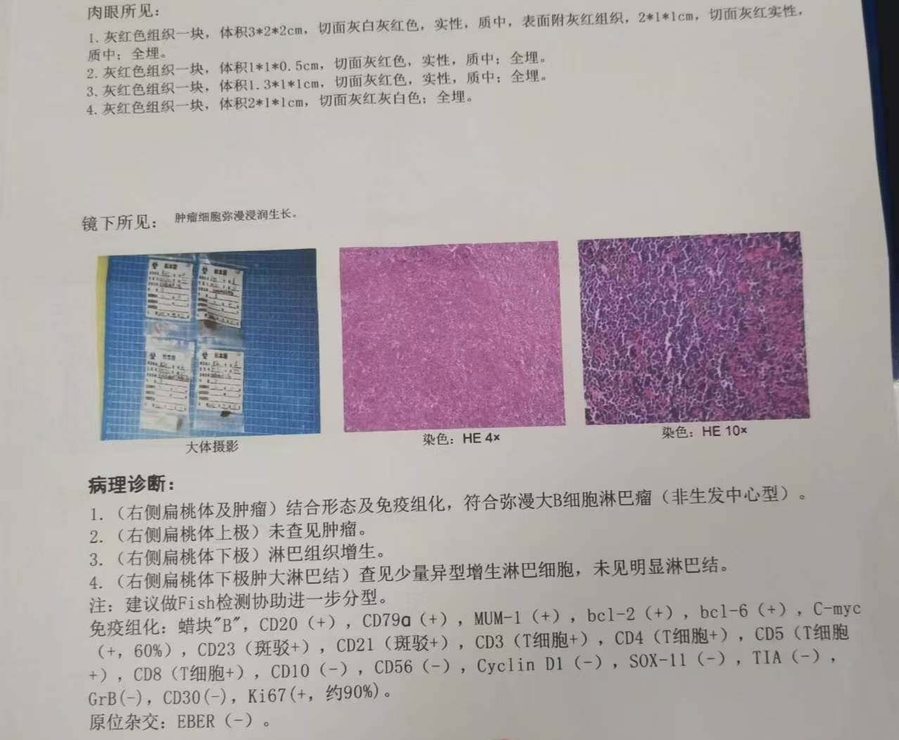 免疫组化报告图片图片