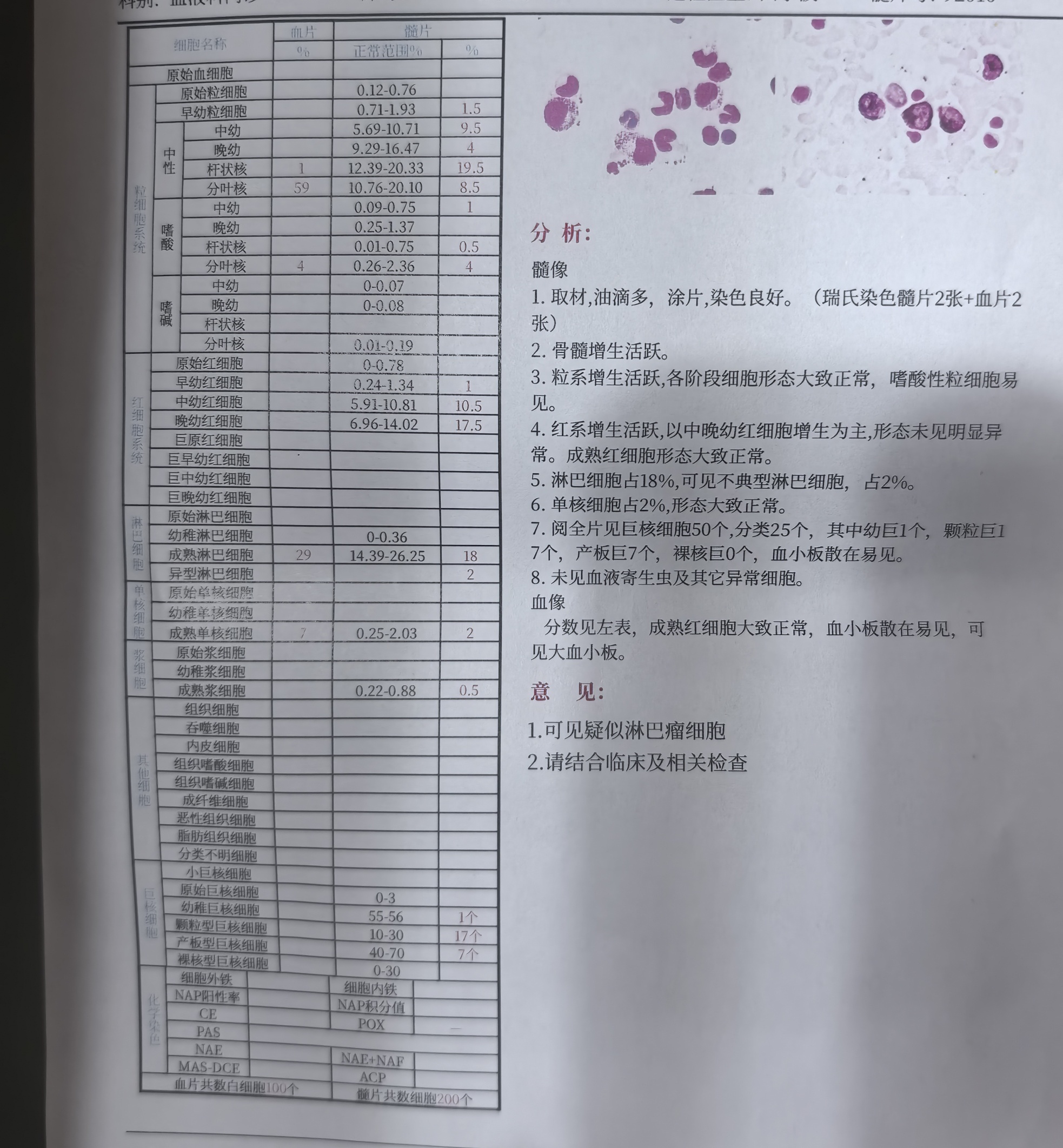 骨髓涂片报告图片